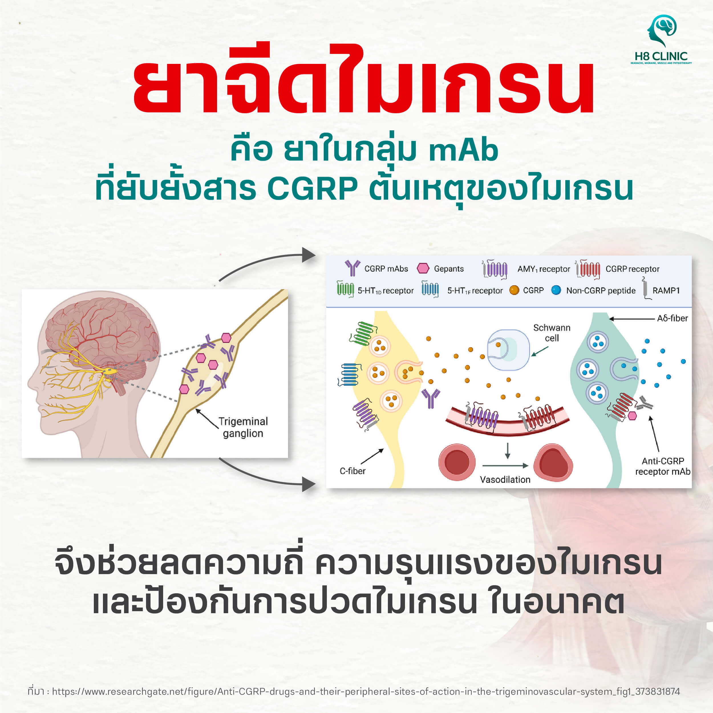 ยาฉีดไมเกรน คืออะไร? 