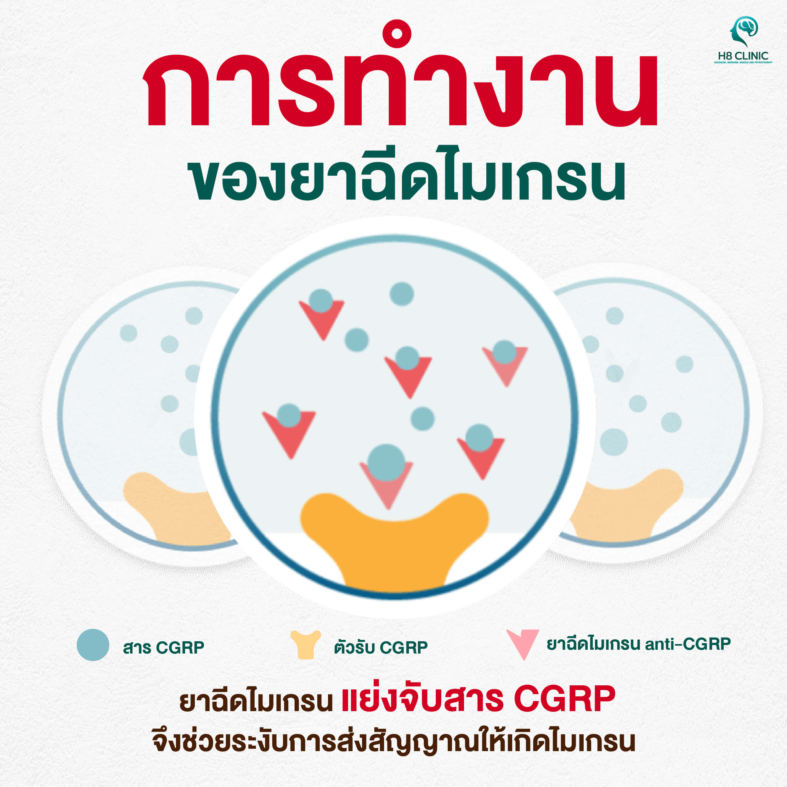 การทำงานของยาฉีดไมเกรน