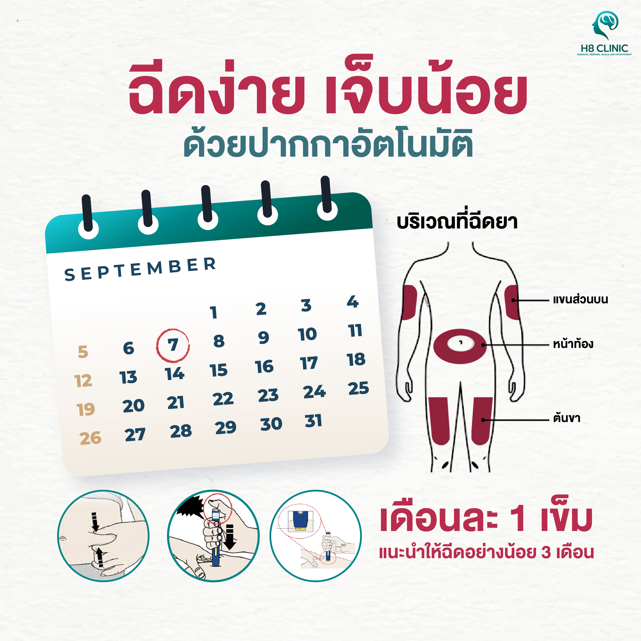 ยาฉีดไมเกรน ฉีดยังไง