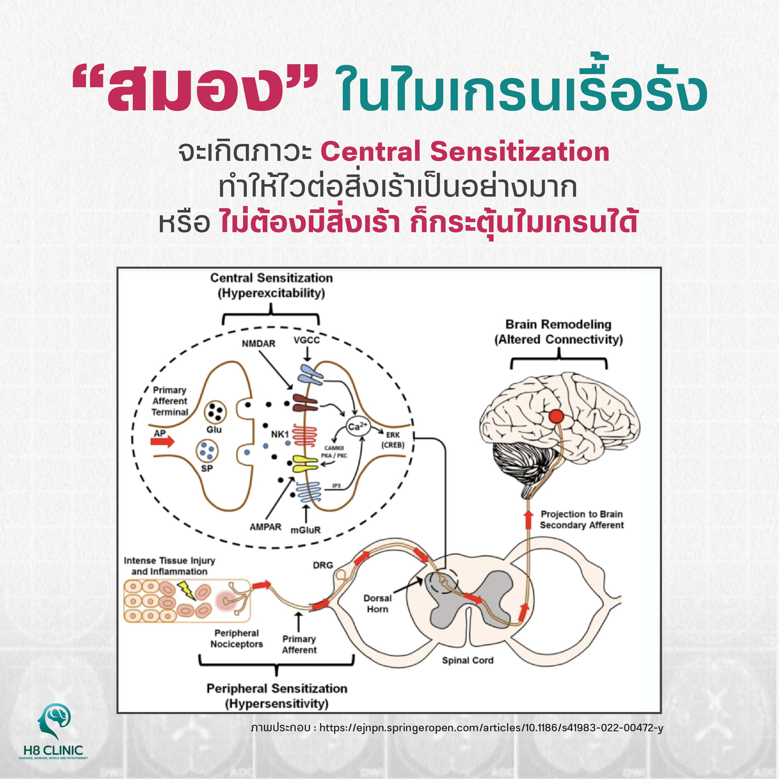 ไมเกรนเรื้อรังคืออะไร ?
