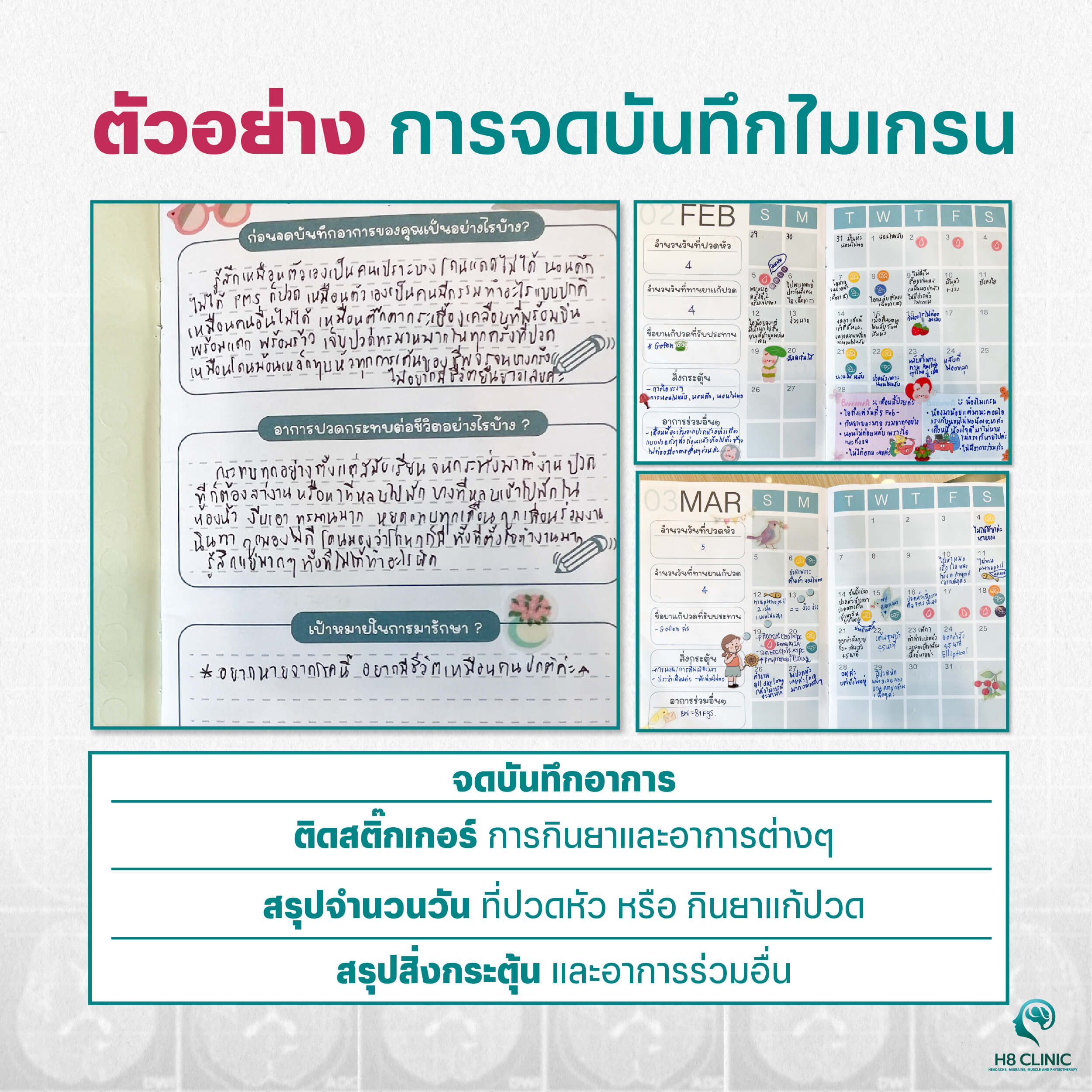 รักษาไมเกรนเรื้อรัง