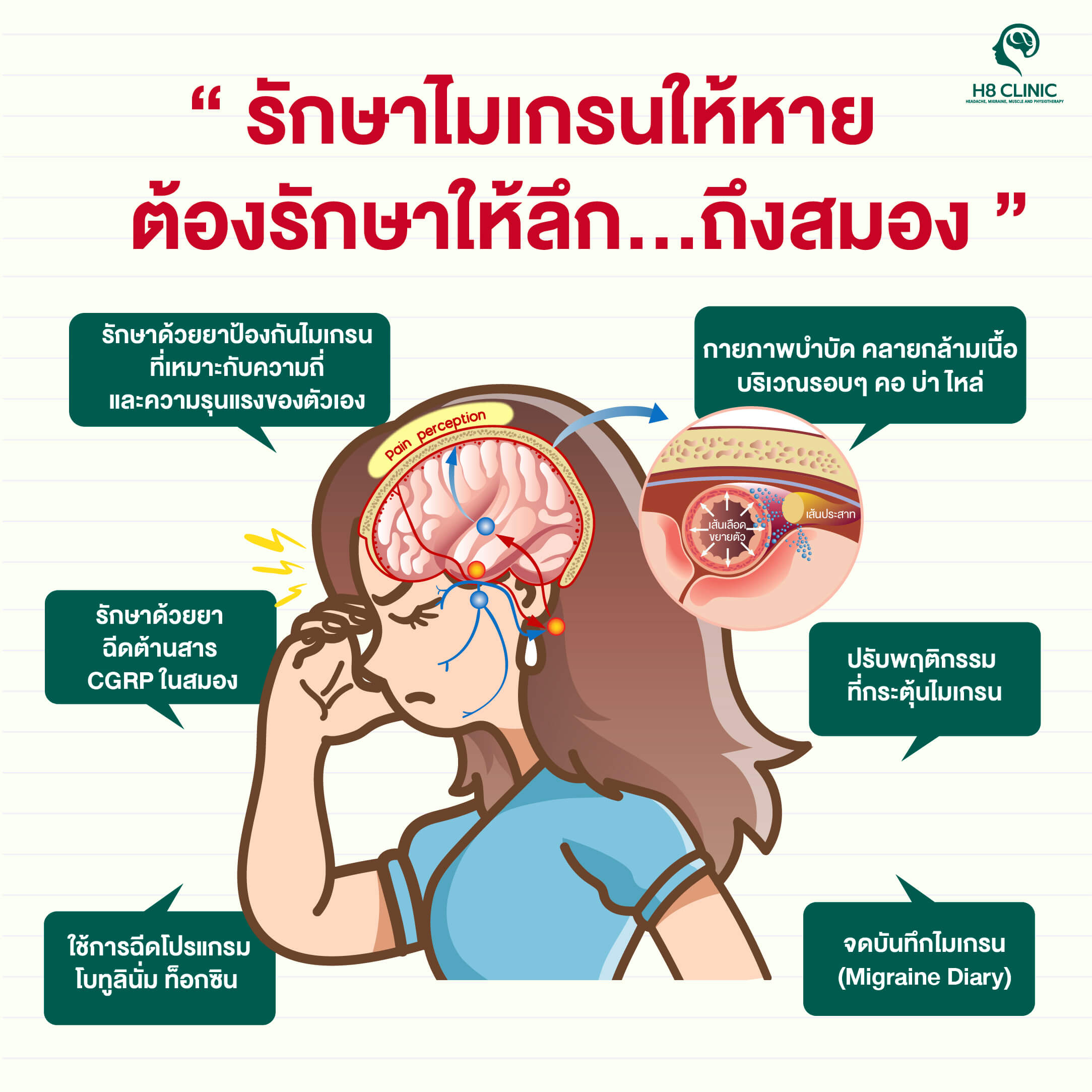 การรักษาไมเกรนอย่างถูกวิธี