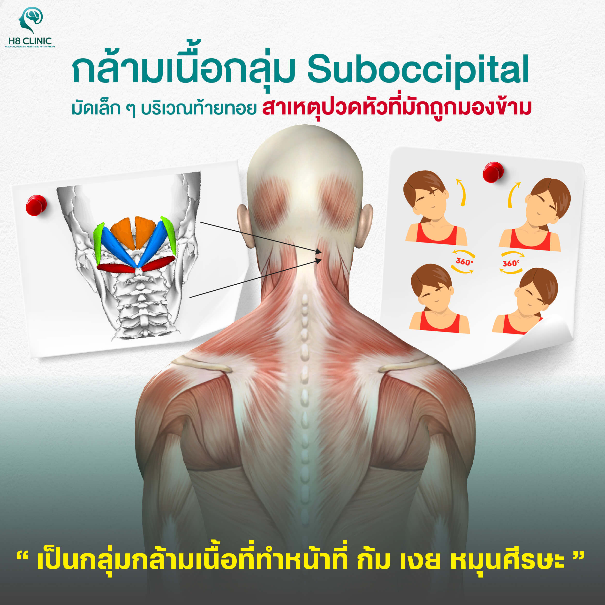กล้ามเนื้อ Suboccipital