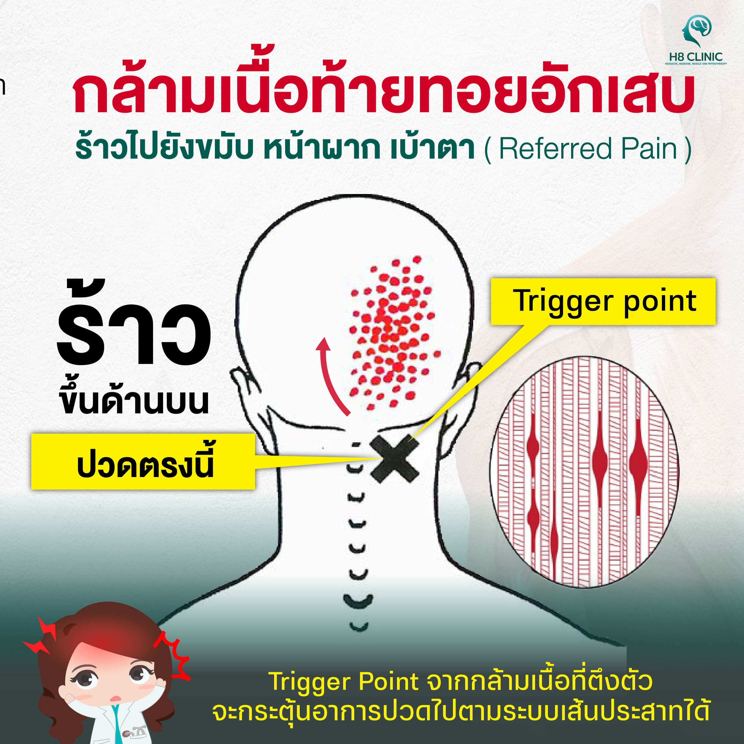 Referred Pain หรือ “อาการปวดร้าวออกนอกตำแหน่ง”