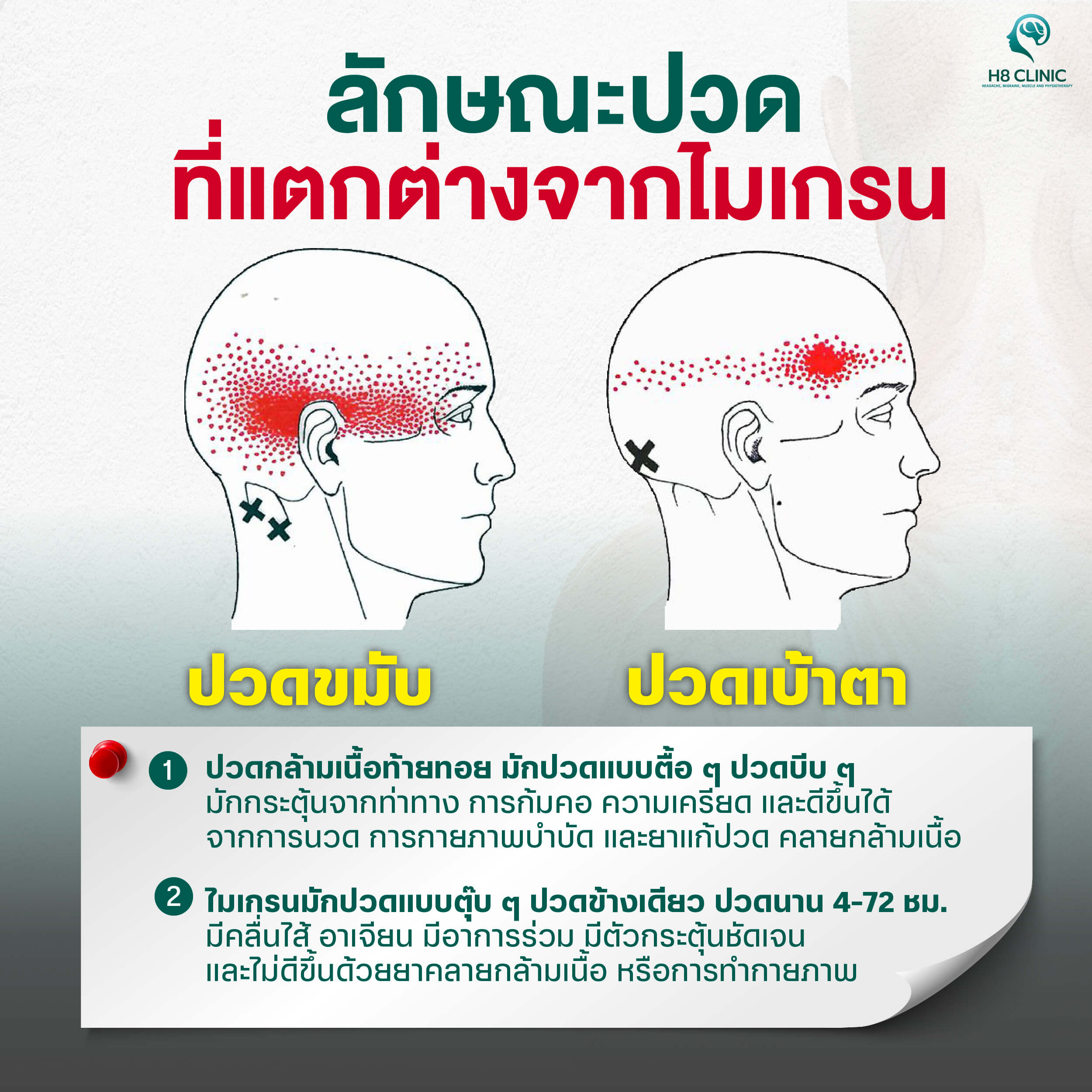 ลักษณะอาการคล้ายไมเกรน แต่ไม่ใช่ไมเกรน