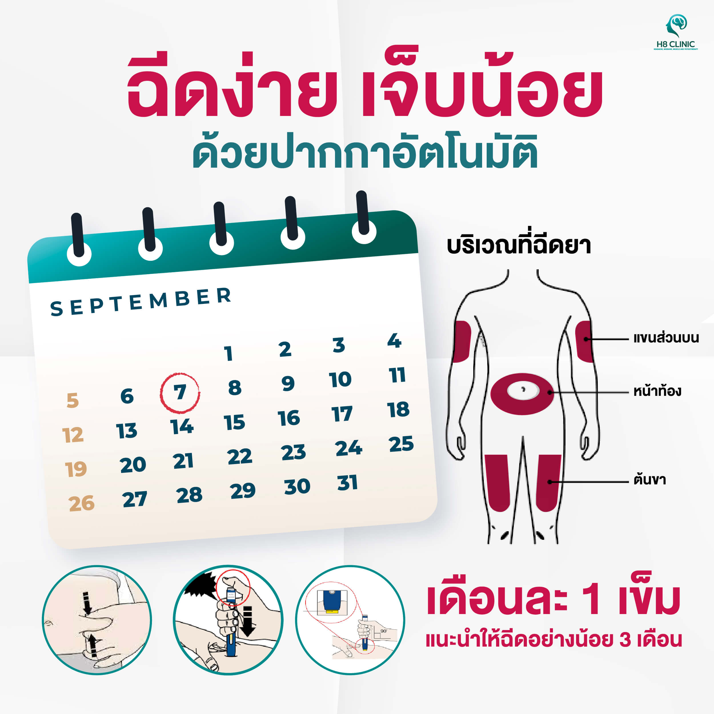 ยาฉีดไมเกรนฉีดยังไง