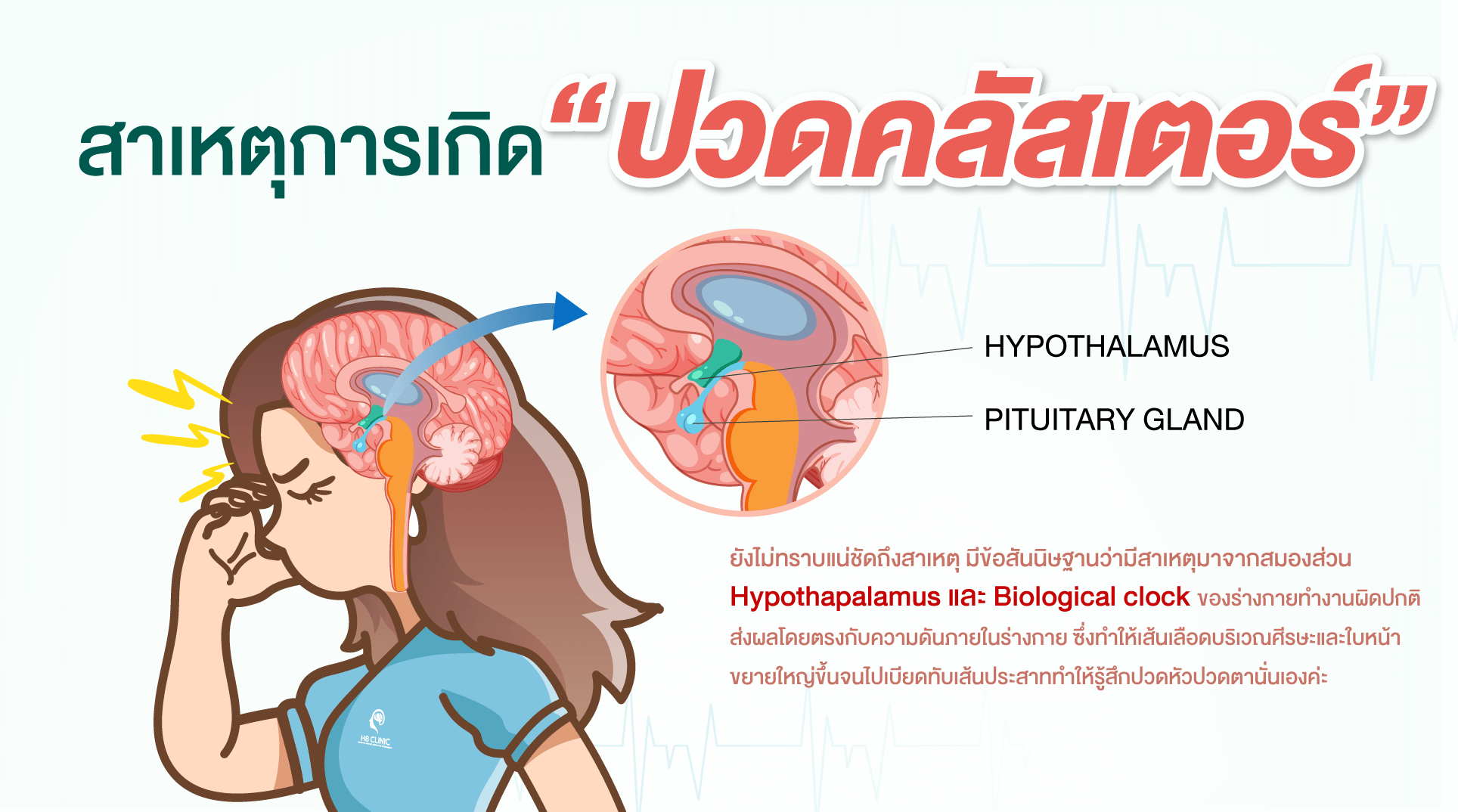 สาเหตุการเกิดปวดคลัสเตอร์