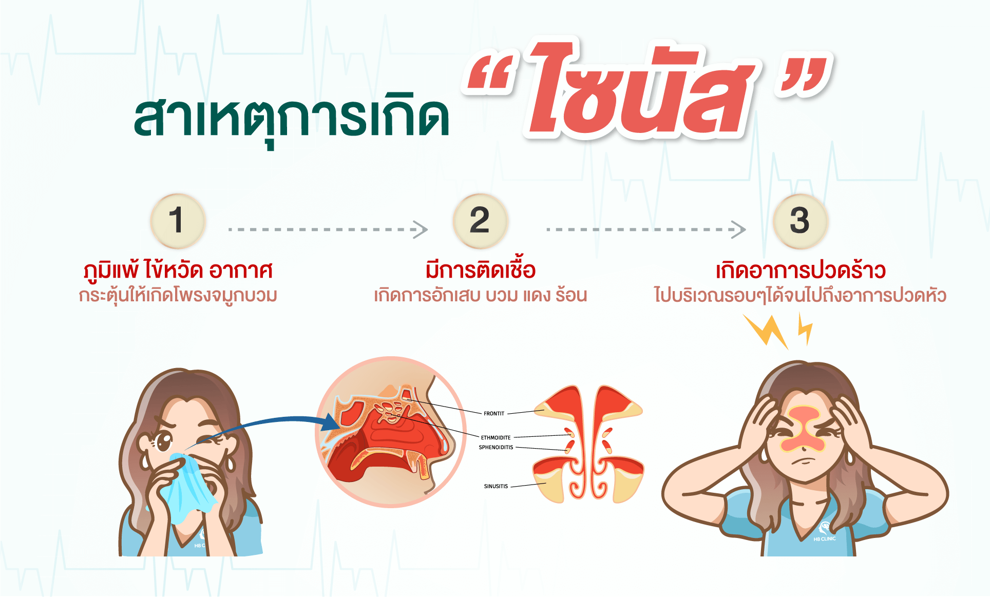 สาเหตุการเกิดไซนัส