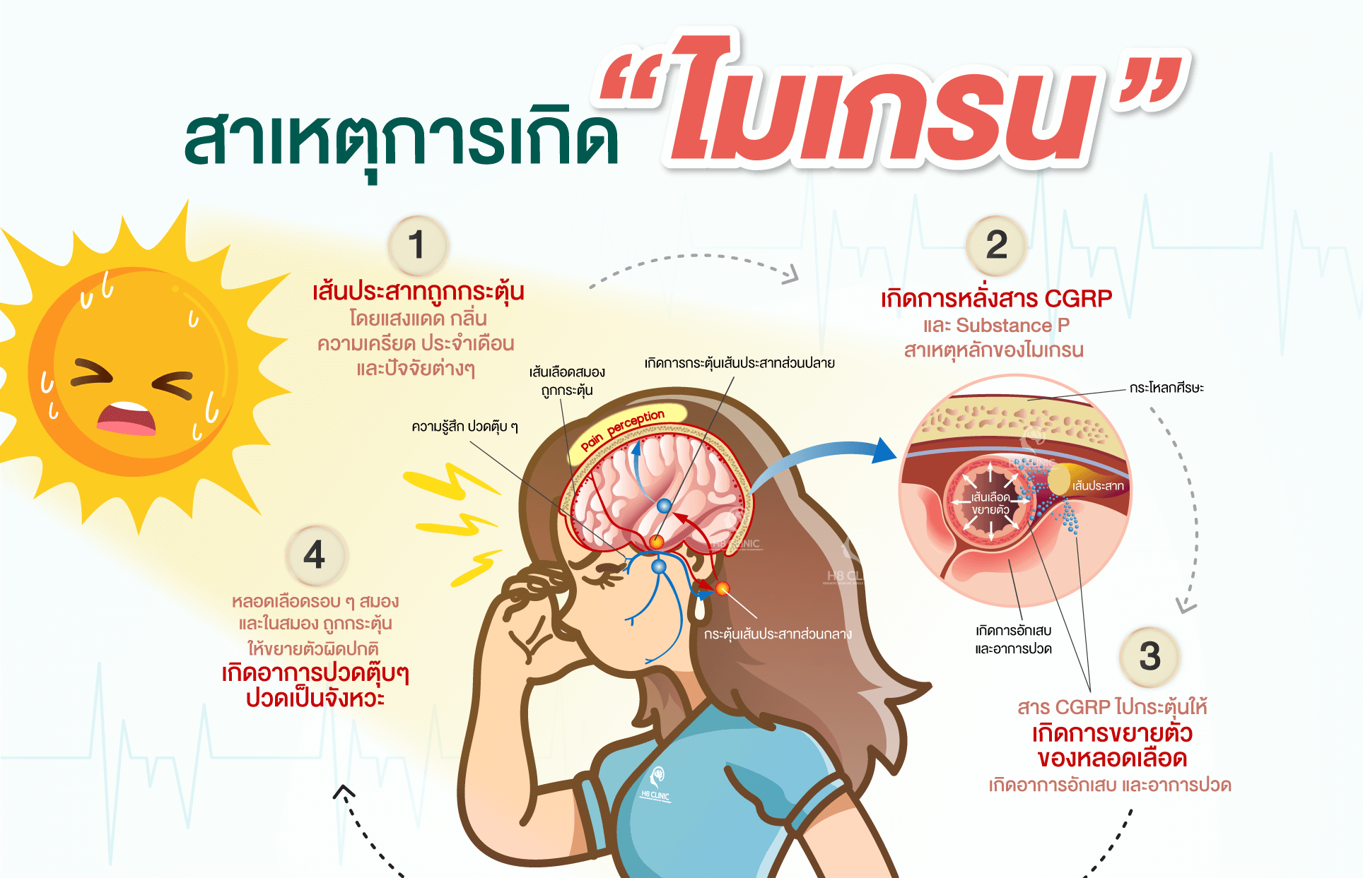 สาเหตุการเกิดไมเกรน