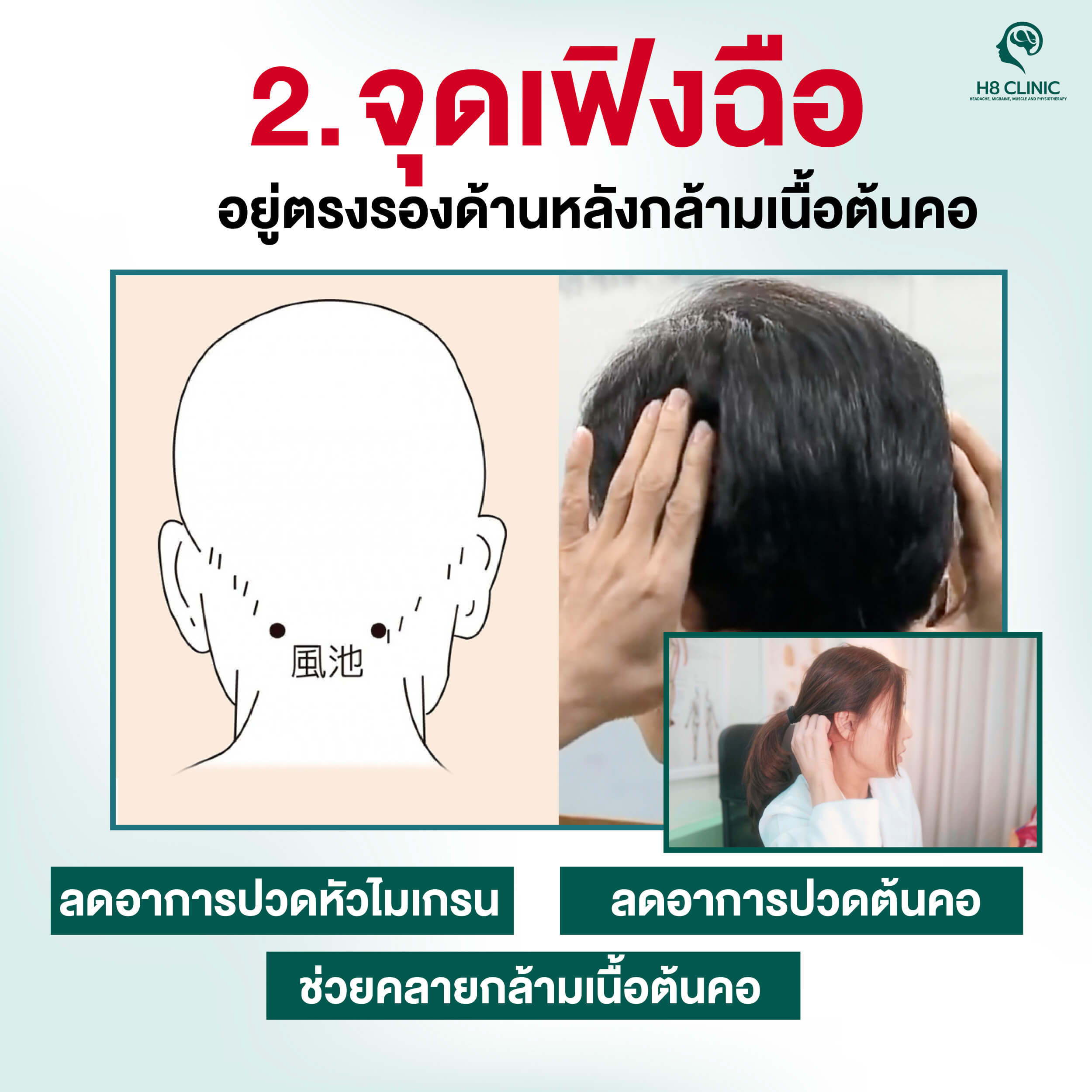 จุดที่ 2 จุดเฟิงชื่อ (Fengchi) คลายปวดขมับ