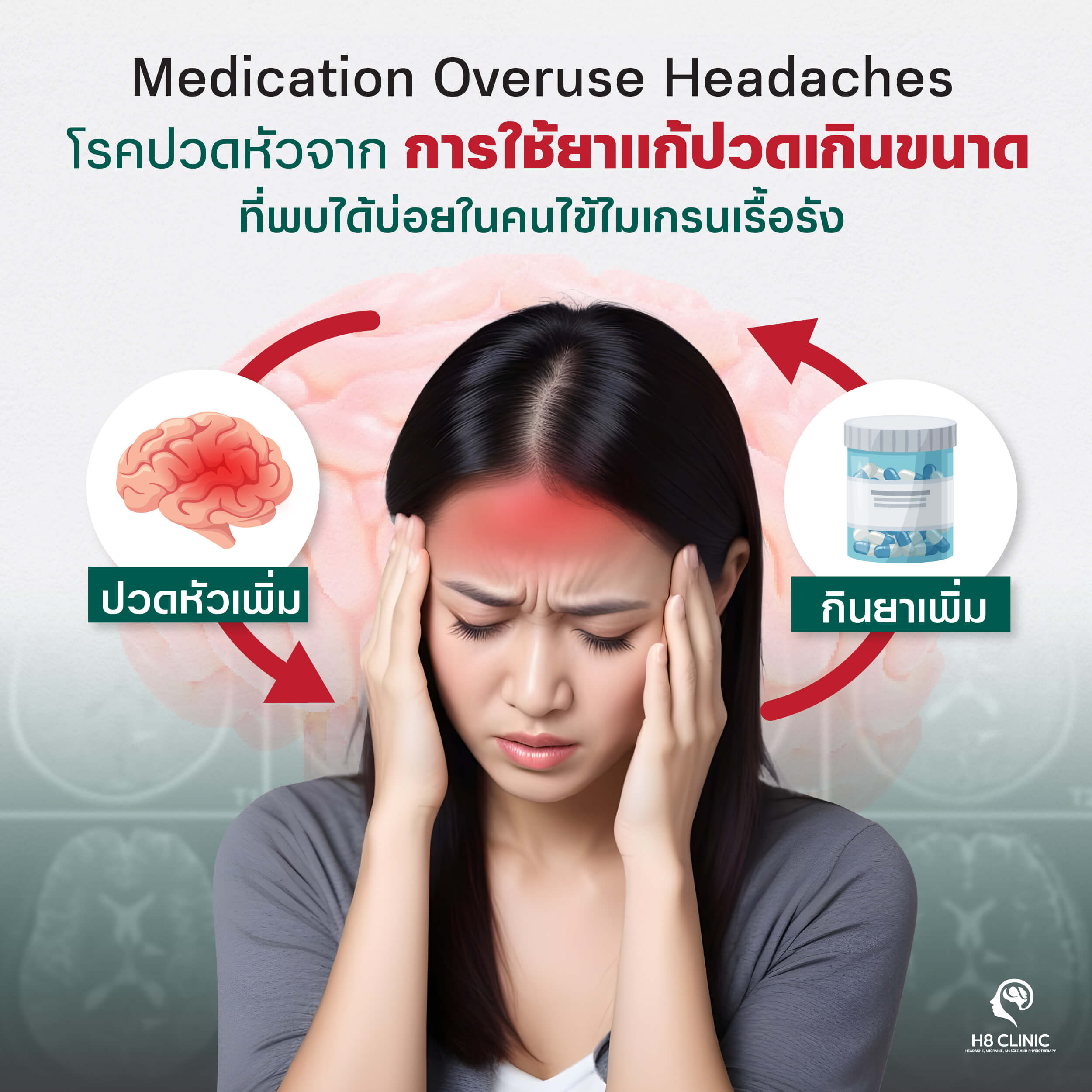 การใช้ยาแก้ปวดที่มากเกินไป เป็นสาเหตุที่ทำให้ไมเกรนเรื้อรังแย่ลง