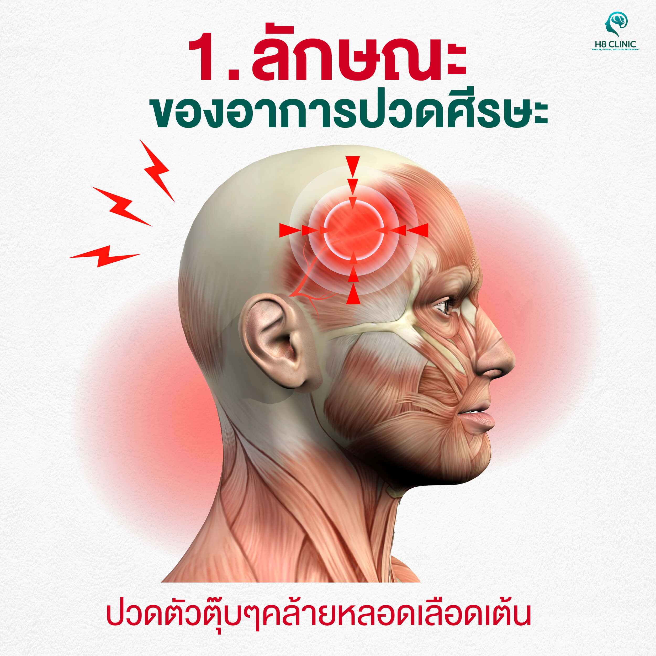 4สัญญาณไมเกรน-03