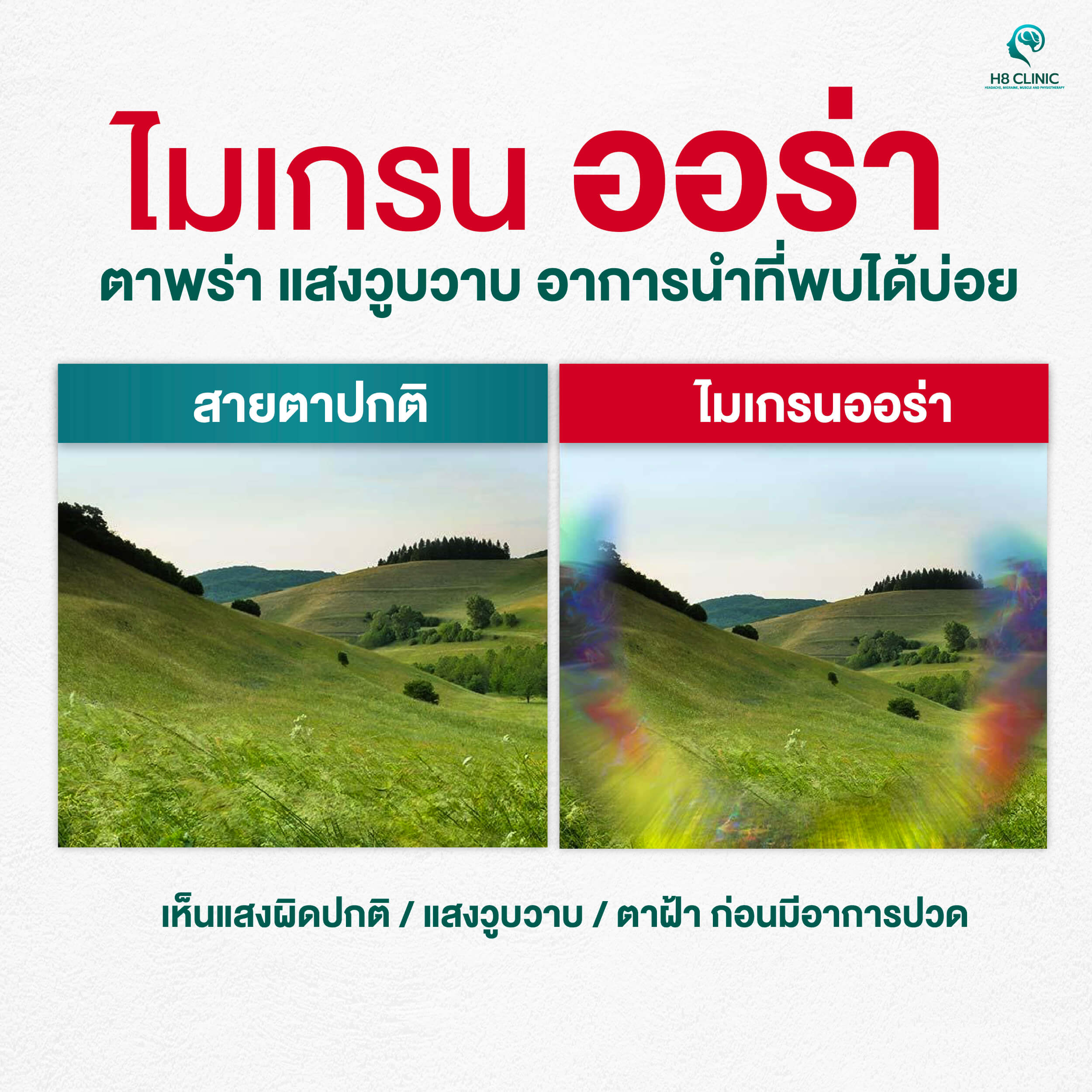 4สัญญาณไมเกรน-08