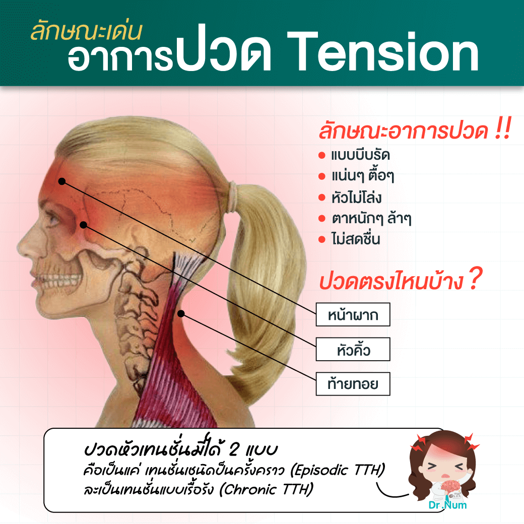 ปวดหัวเทนชั่น